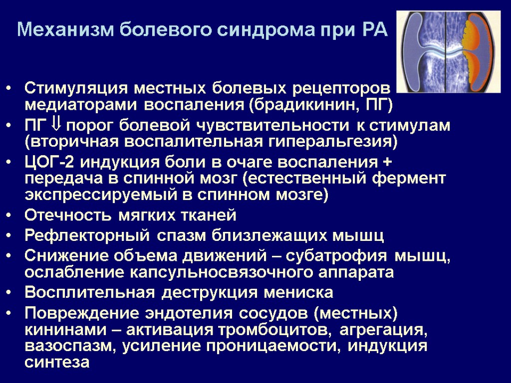 Механизм болевого синдрома при РА Стимуляция местных болевых рецепторов медиаторами воспаления (брадикинин, ПГ) ПГ